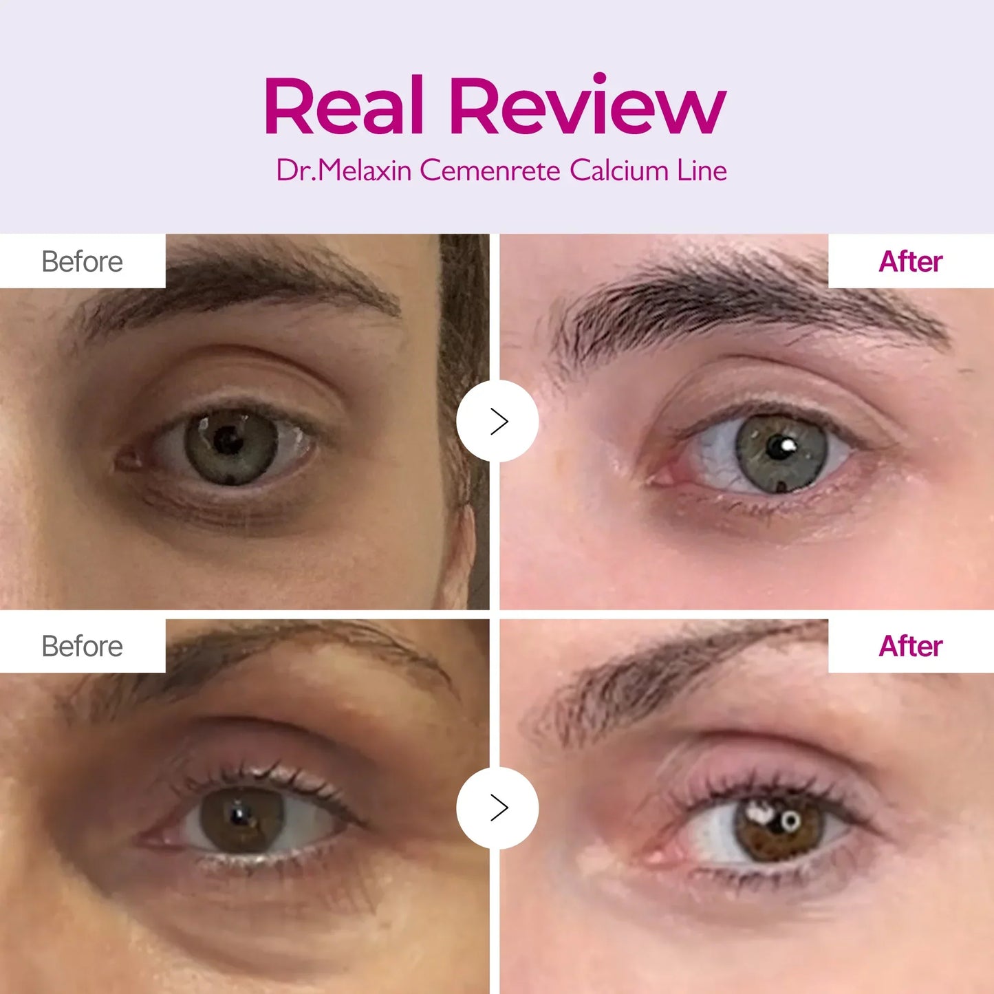 Calcium Eyecare Routine Set