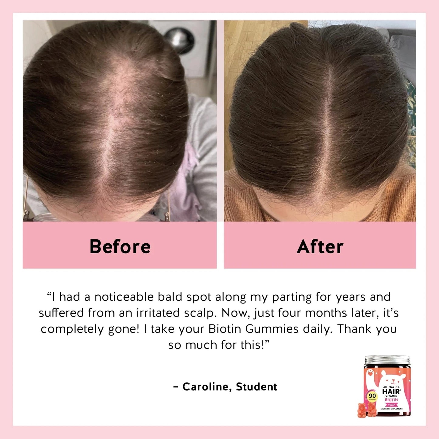 Biotin Gummies for Hair Skin & Nails. 5000 mcg High Potency Vegan Vitamins fo...
